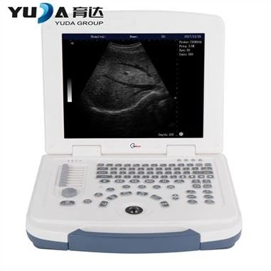Máy quét siêu âm kỹ thuật số máy tính xách tay 3D